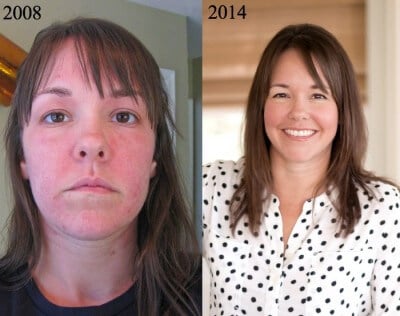 How-I-Reversed-Hashimotos-Disease-Naturally.jpg